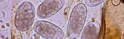 In the Poo! An introduction to Faecal Worm Egg Counts for Sheep Webinar Recording 1 eggs 2